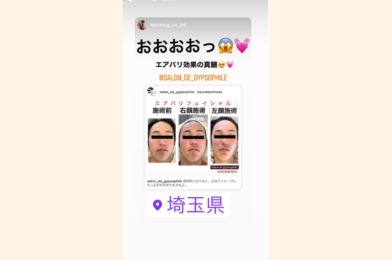 8F794412-8B09-4C57-9A69-8AAE9F810CC7
