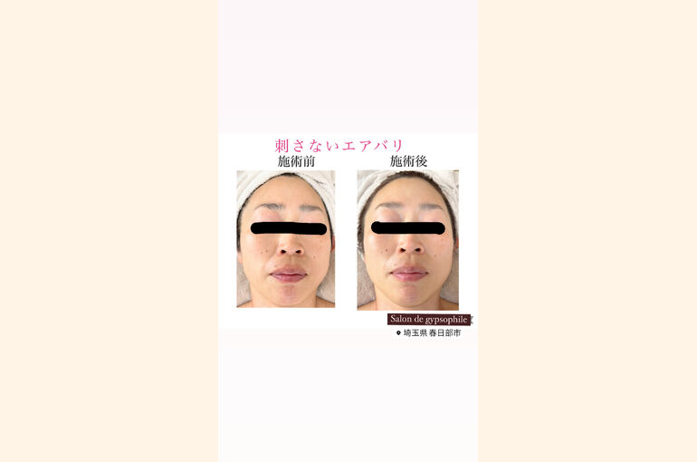 20230714_050543786_iOS